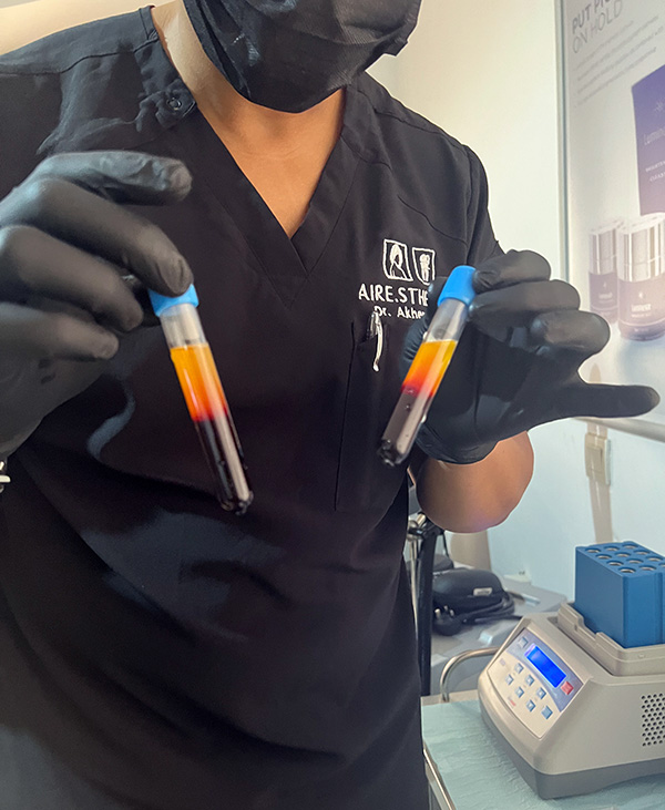 Regenerative Therapy