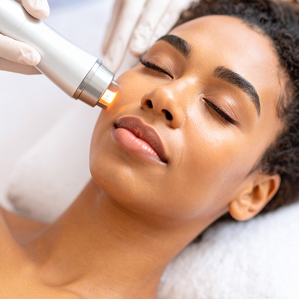 Non-ablative skin resurfacing treatments Lagos nigeria